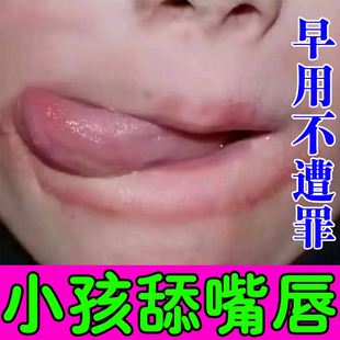儿童嘴巴一圈红专用孩子舔嘴唇干裂红肿疼痛去羊胡子疮口周唇炎膏