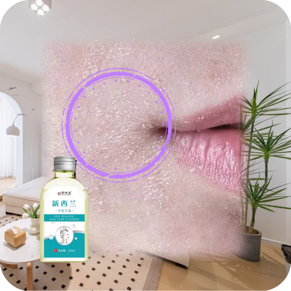 脸部干燥起皮脸干痒紧绷脸干掉皮秋冬季脸上起皮脸干脸上脱皮掉皮