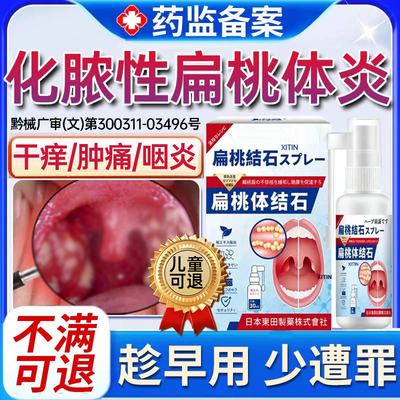 急性化脓性扁桃体炎专用喷雾剂喉咙肿痛扁桃体炎用的嗓子疼红肿PP