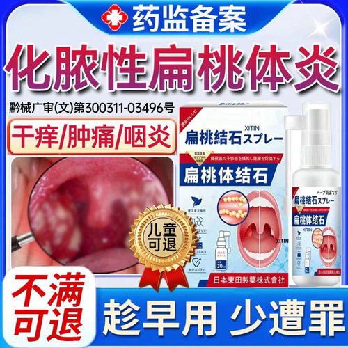 化脓性扁桃体炎修复喷剂