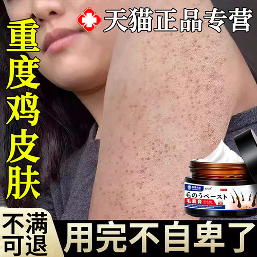 【专攻鸡皮肤】鸡皮疙瘩