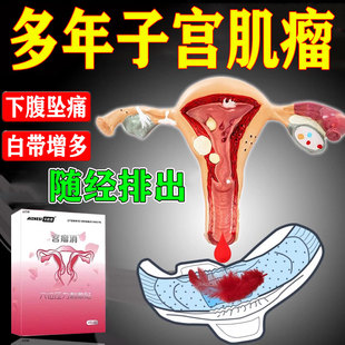 子宫肌瘤中膏药贴调理自己治宫瘤清卵巢囊肿成艾灸消除热敷茶包GX
