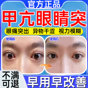 甲亢眼突热敷眼贴引起视力模糊眼球凸出眼睛疼痛肿胀甲减专用贴WY