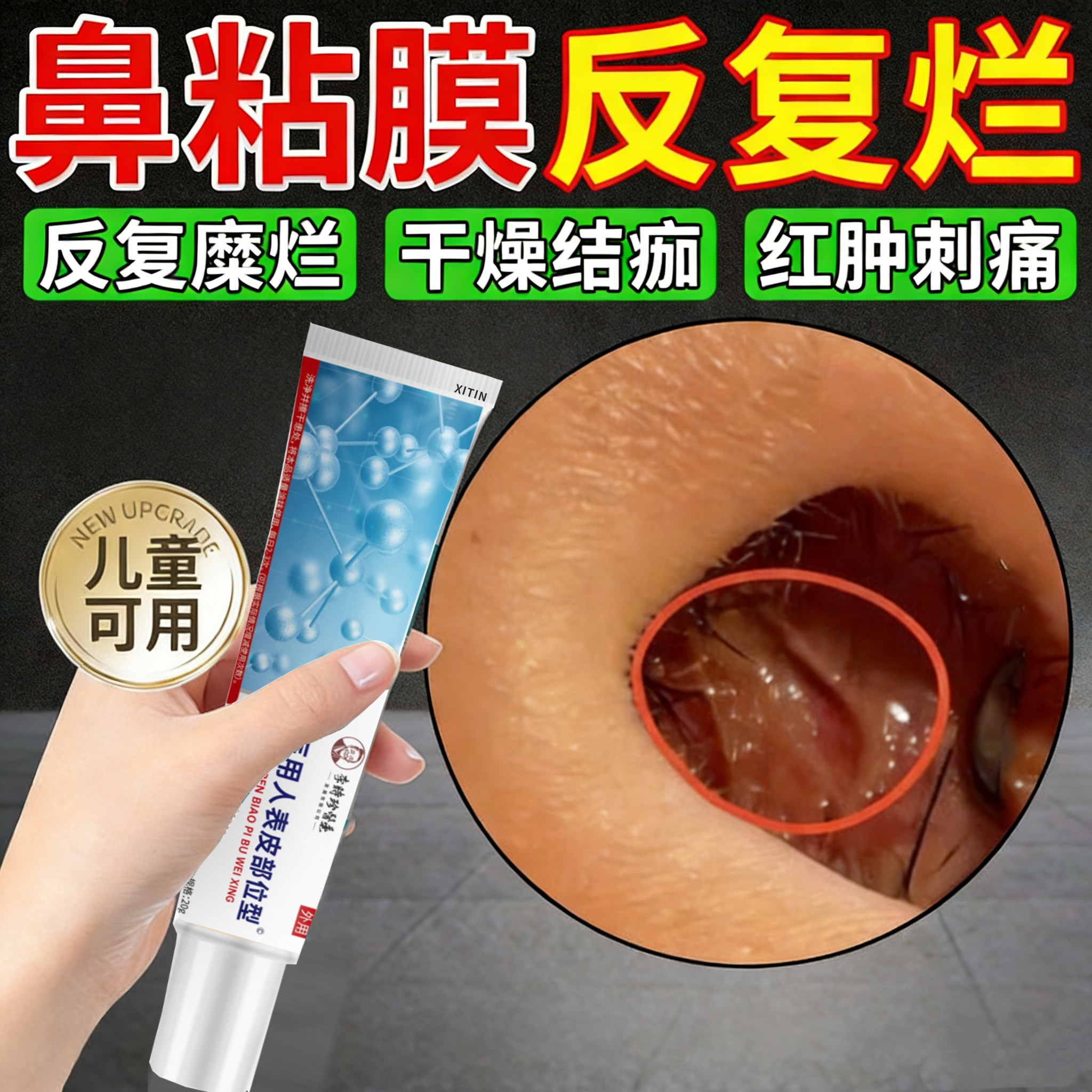 鼻中隔鼻腔溃疡上火鼻子生疮结痂鼻黏膜糜烂干燥性鼻炎修复药膏PP