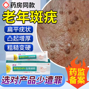 脸上扁平疣专用老年斑增厚凸起老人疣一抹灵专用脸部黑斑去除膏UU