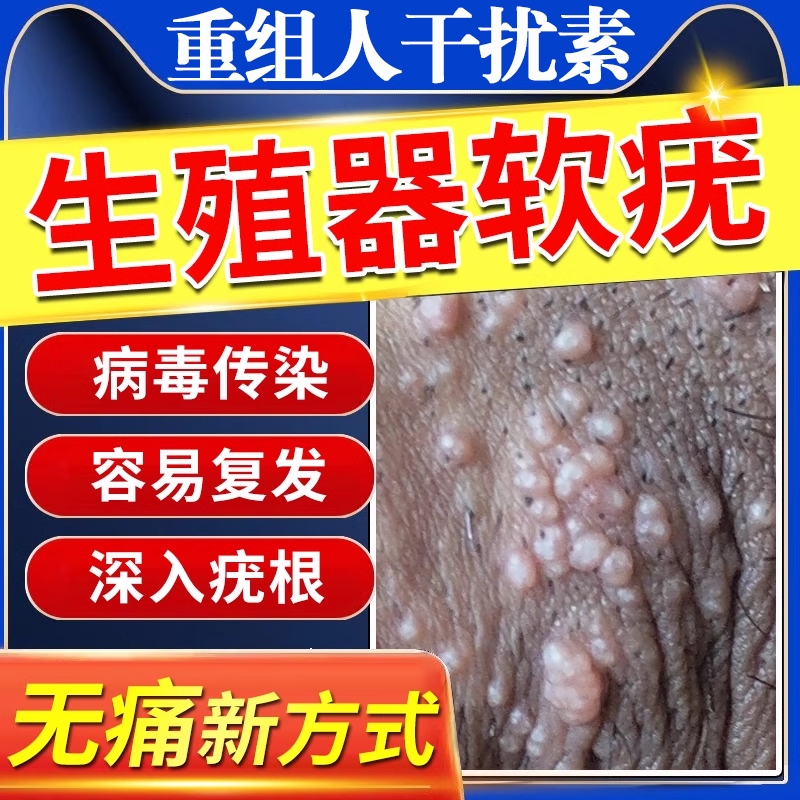 生殖器软疣传染性病毒
