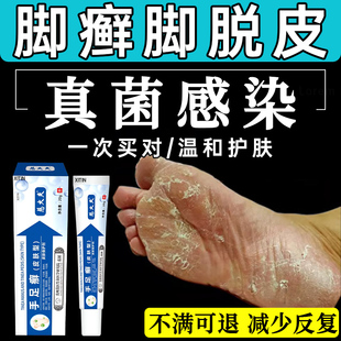 角化型足癣脚癣一次净官方旗舰店脚脱皮干裂真菌感染贵州神奇止UU