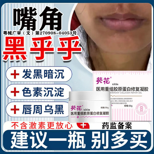 嘴角发黑黑色素沉淀去除改善唇周黑唇黑嘴角暗沉唇炎色素沉着膏LT