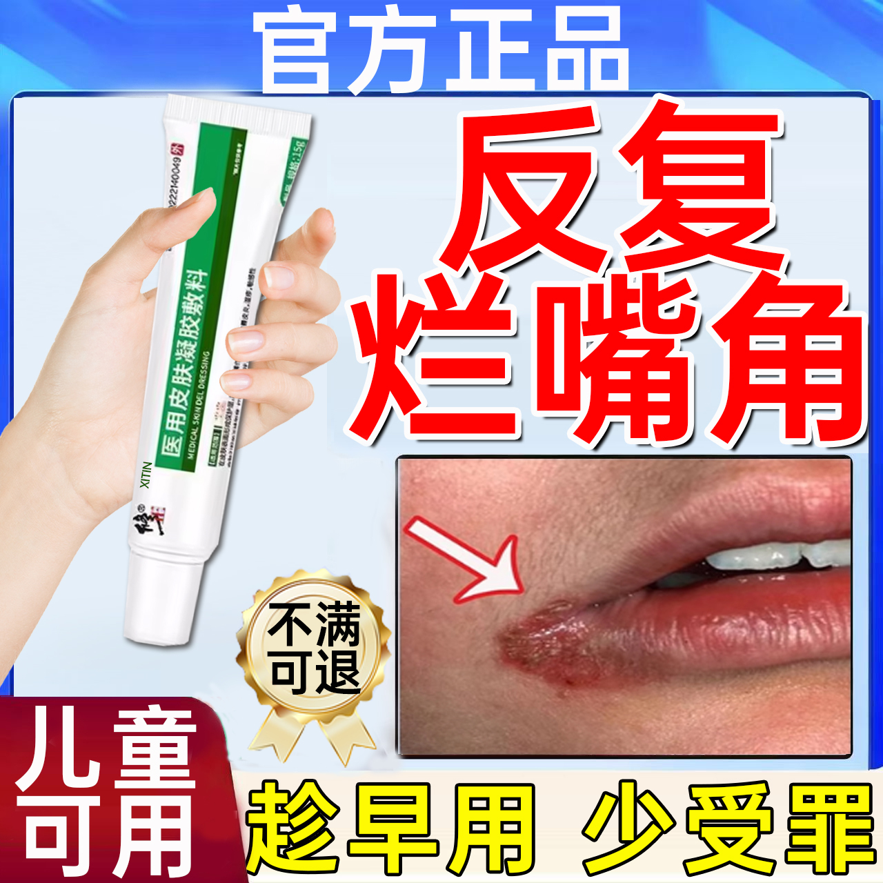 口角炎修复凝胶