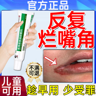 口角炎烂嘴角药膏儿童唇炎唇膏嘴唇干裂脱皮医用型嘴巴上火起泡WY