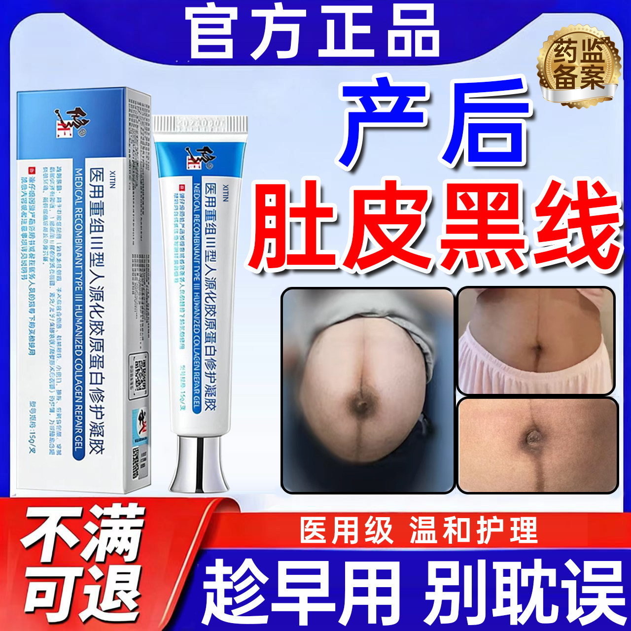 产后肚子黑色素沉淀去除膏腹部妊娠纹黑线淡化黑棘皮美白修复霜UU