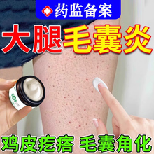 鸡皮肤疙瘩毛囊角化症专用药去除神器全身手臂大腿部毛囊炎痘痘UU