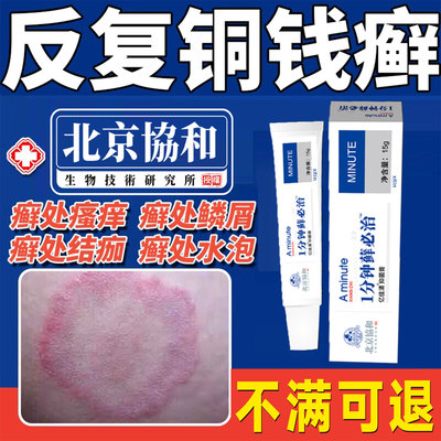 铜钱癣体癣专膏用真菌感染药皮肤瘙痒红斑外用金钱去藓特抑菌效GX