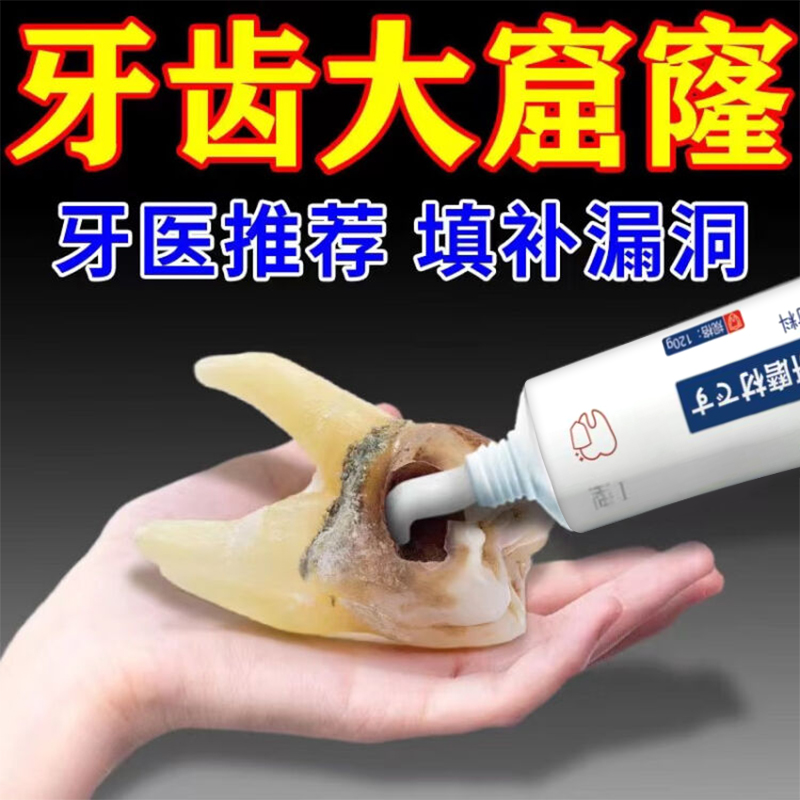 再生硅修复牙膏正品旗舰店蛀牙龋齿修复牙洞自己补清理牙虫的药LL