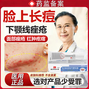 下颚线淋巴痘腮边痘专用下巴痤疮结节硬块痘痘面膜可搭配祛痘膏MR