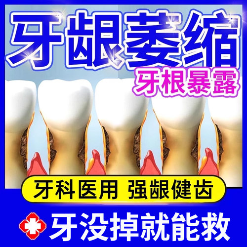 【李时珍牙科分离剂】牙龈萎缩