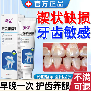 牙齿锲状缺损修补牙膏牙齿敏感酸痛牙髓炎牙齿横折牙根修复专用WY