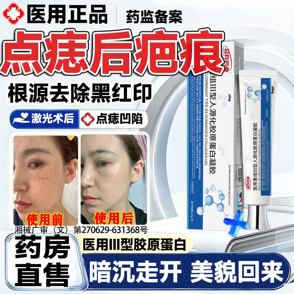激光点痣后修复膏疤痕红印去黑印色素沉淀医用消除祛黑疙瘩凹陷LT图片