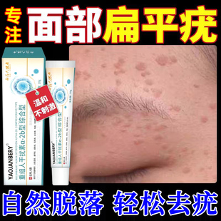 干扰素b2凝胶去疣药膏扁平疣丝状神器去除膏一抹灵面颈部专用UU