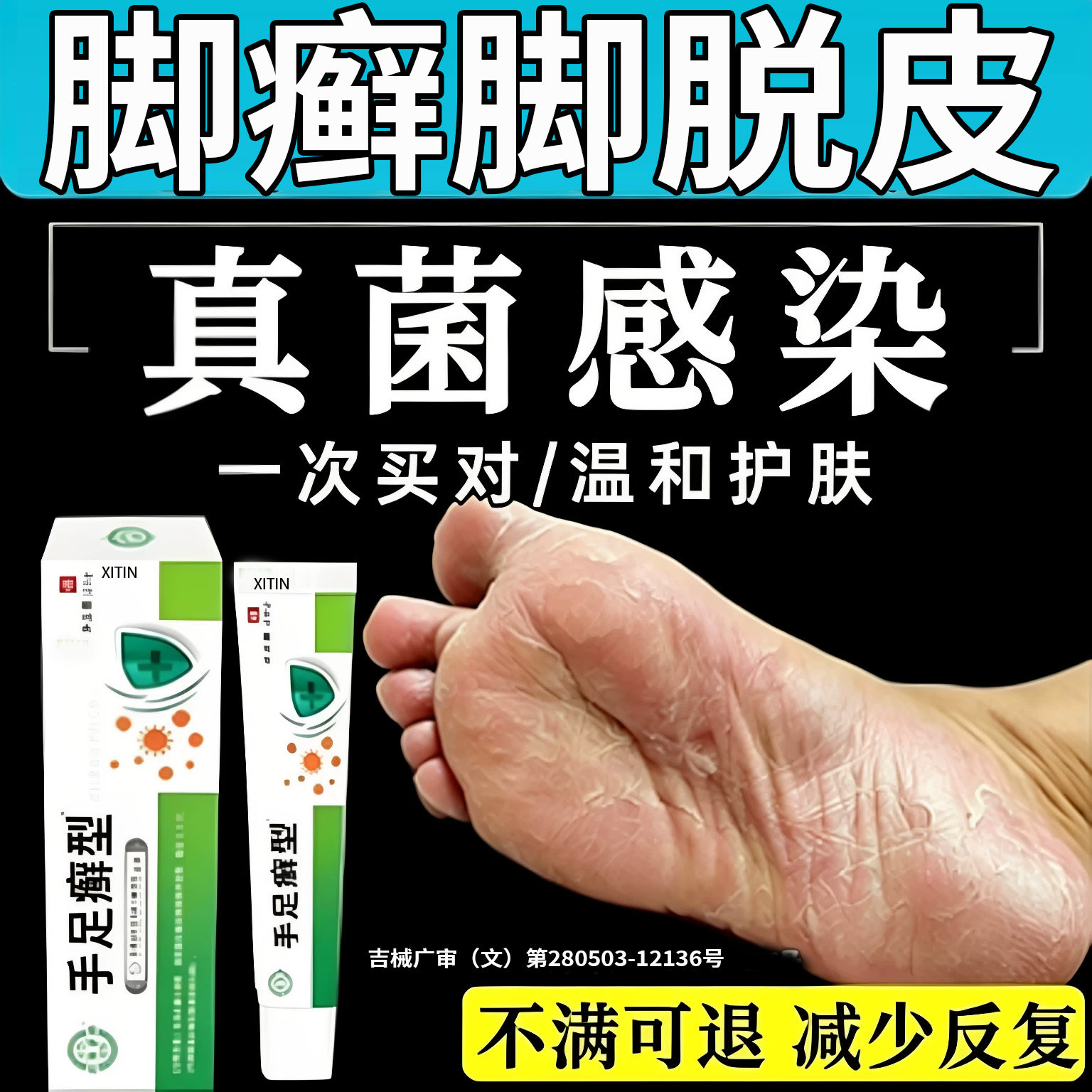 角化型足癣脚癣一次净官方旗舰店脚干裂脱皮真菌感染贵州神奇止UU - 实物图
