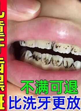 儿童牙齿黑色素沉淀去牙菌斑牙膏黑线黑斑黑渍污垢祛除神器美白GX
