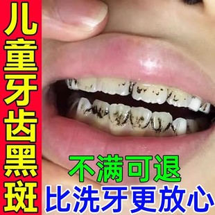 儿童牙齿黑色素沉淀去牙菌斑牙膏黑线黑斑黑渍污垢祛除神器美白GX
