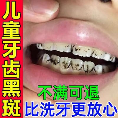 儿童牙齿黑色素沉淀去牙菌斑牙膏黑线黑斑黑渍污垢祛除神器美白GX