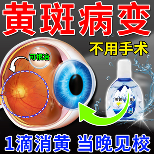 极速去眼底黄f斑病变眼水眼白清澈发黄滴眼液老人眼睛混浊模糊看