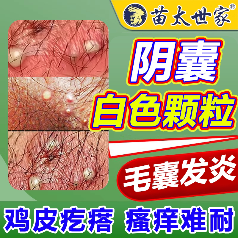 男性私处白色点颗粒皮脂腺疙瘩蛋蛋阴囊毛囊炎下体阴毛潮湿脓包wg