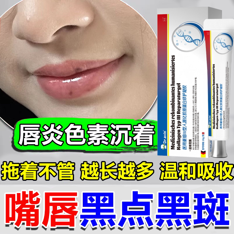 嘴唇周围黑斑点去除唇炎引起色素沉着唇部护理淡化黑色素医用型wg