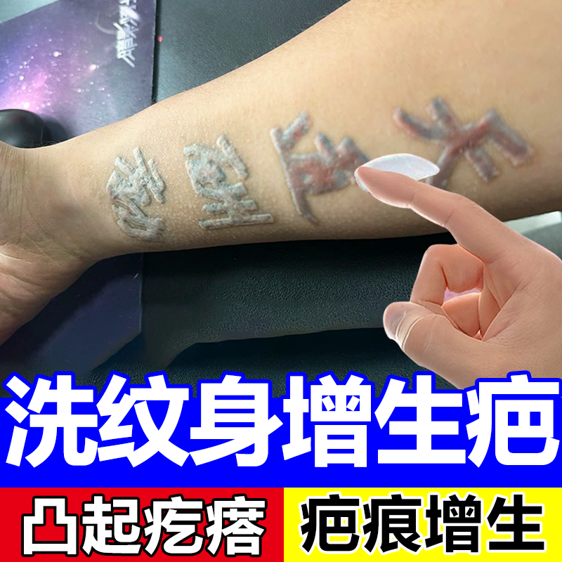 洗纹身疤痕增生色素沉着医用