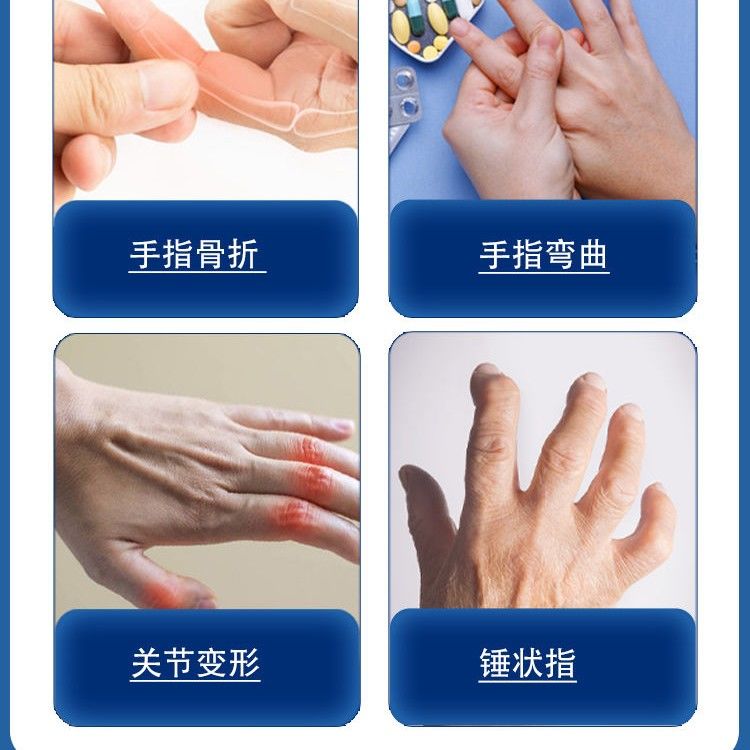 极速手指固定夹板指套关节骨折矫正器大J小拇指中食指无名指弯曲