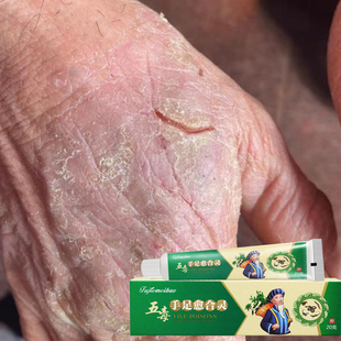 手指头裂口子干裂修复护手霜开裂脱皮裂开手足开口手脚冬季裂膏