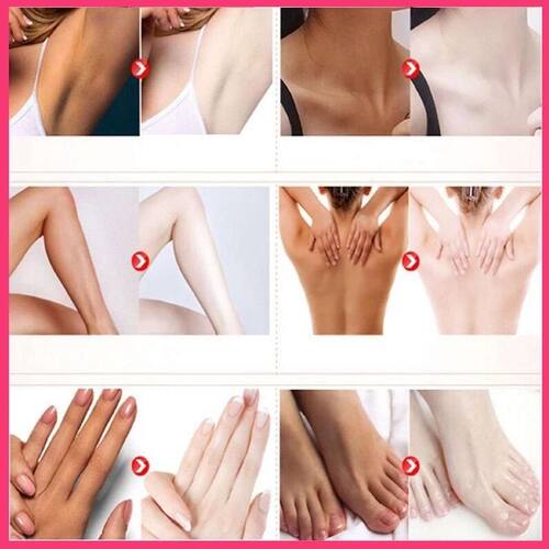 极速Intimate Area Pink Essence Underarm ILnner Thigh Ankle E