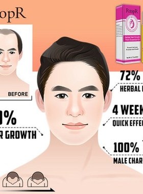 极速Herbal Hair Growth Anti Hair Loss LiquMid Promote Thick