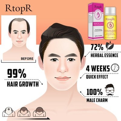 极速Herbal Hair Growth Anti Hair Loss LiquMid Promote Thick