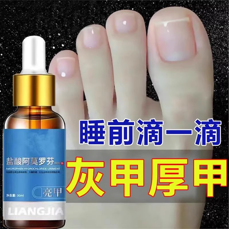 阿莫罗芬搽剂趾甲坏甲空甲烂灰指空甲增厚发黄快速修复抑菌