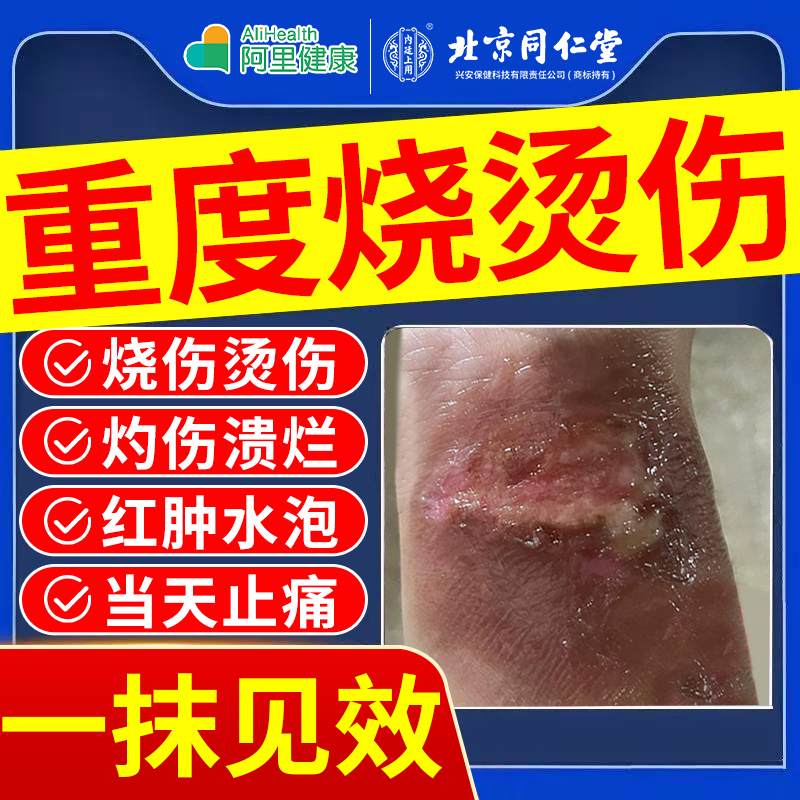 【阿里药房直售】重度烧烫伤专用