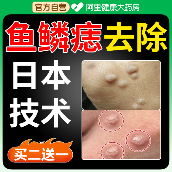 鱼鳞痣药膏去猴子肉粒疙瘩祛手上脚上硬疙瘩扁平疣刺猴去除药膏