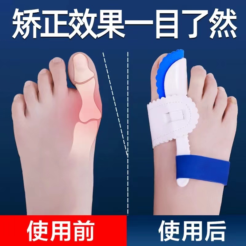 大脚趾矫正器成人矫正