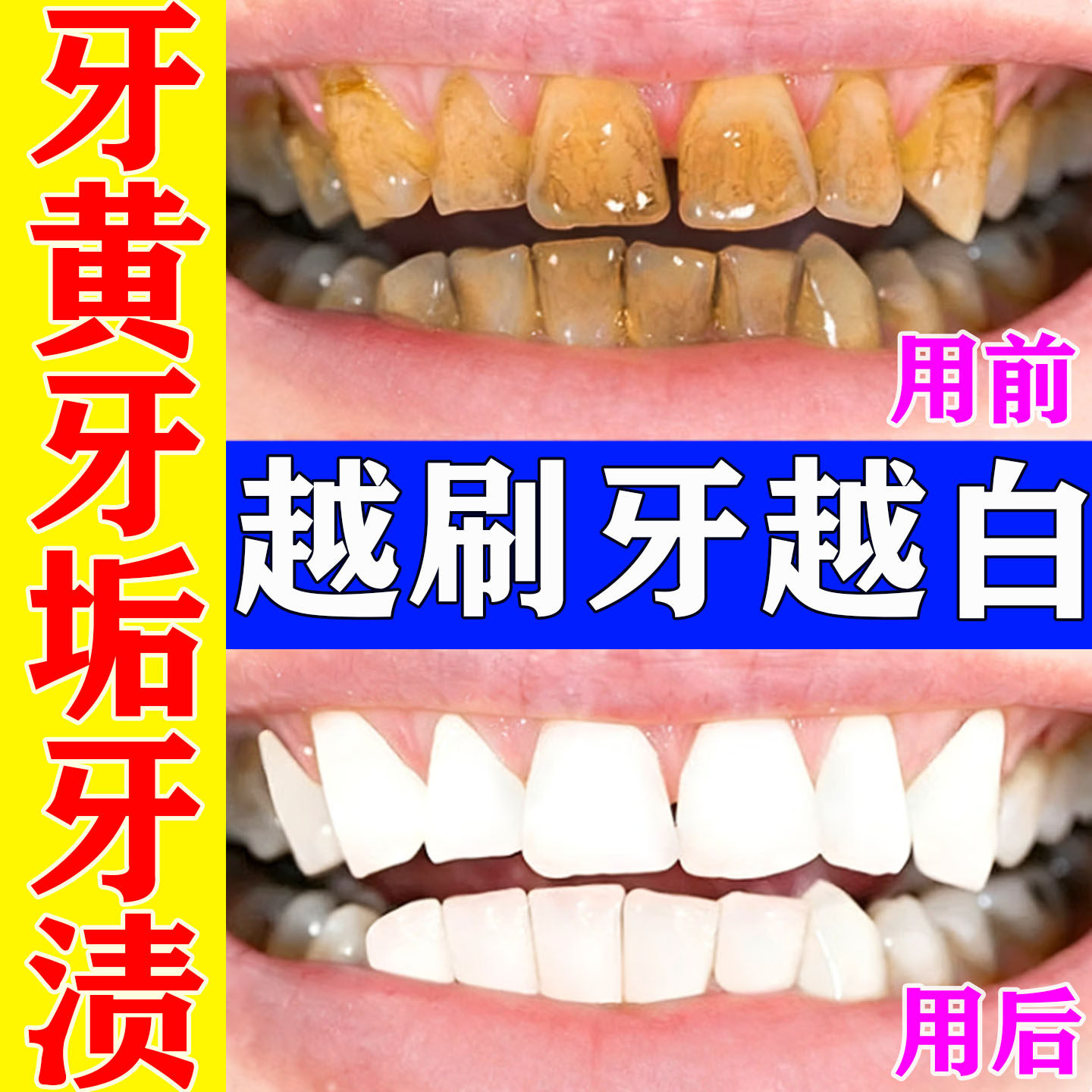 黑森林草本牙粉清新口气美白去黄烟渍清洁污垢溶解牙石纯植物牙粉