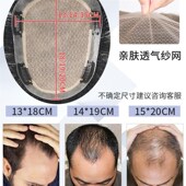 极速假发男d士短发全真人发丝头顶补发片贴片烫发栗子头顶韩版 隐