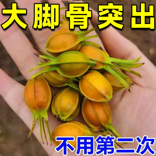 极速拇外翻贴【早用n早好】拇指外翻矫正神器大脚骨突出变形脚趾
