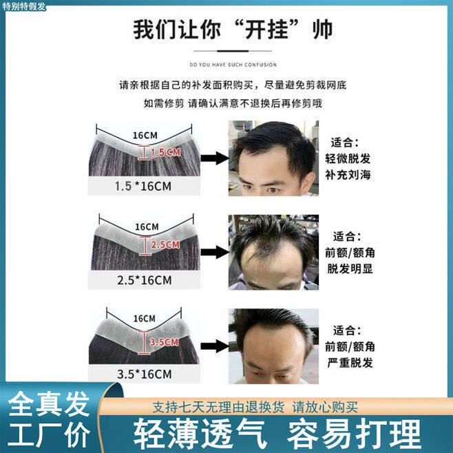 极速发际线假发男士假发片前额隐形贴真发男头顶T补发块男生假刘