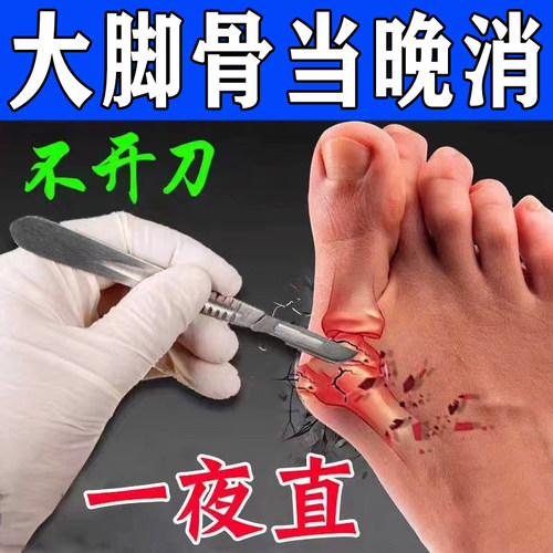 极速【一贴就直】拇外翻矫正贴z大脚骨拇指外翻肌贴脚趾重叠专用