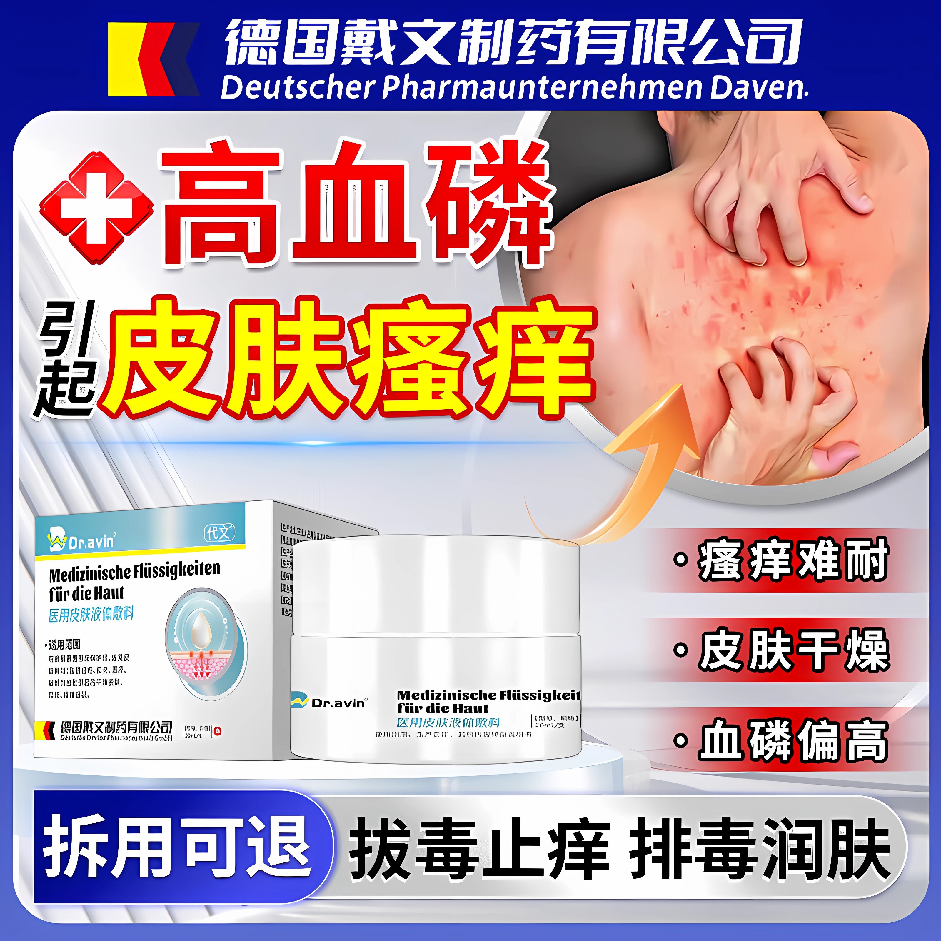 德国品牌高血磷引起尿毒症皮肤瘙痒全身皮肤干燥代文拔毒止痒膏ZR