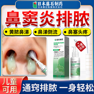鼻窦炎排脓喷雾剂专用鼻涕倒流鼻炎喷剂治疗鼻后滴漏可搭膏药贴AZ