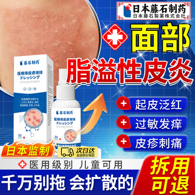 【日本藤石】面部脂溢性皮炎
