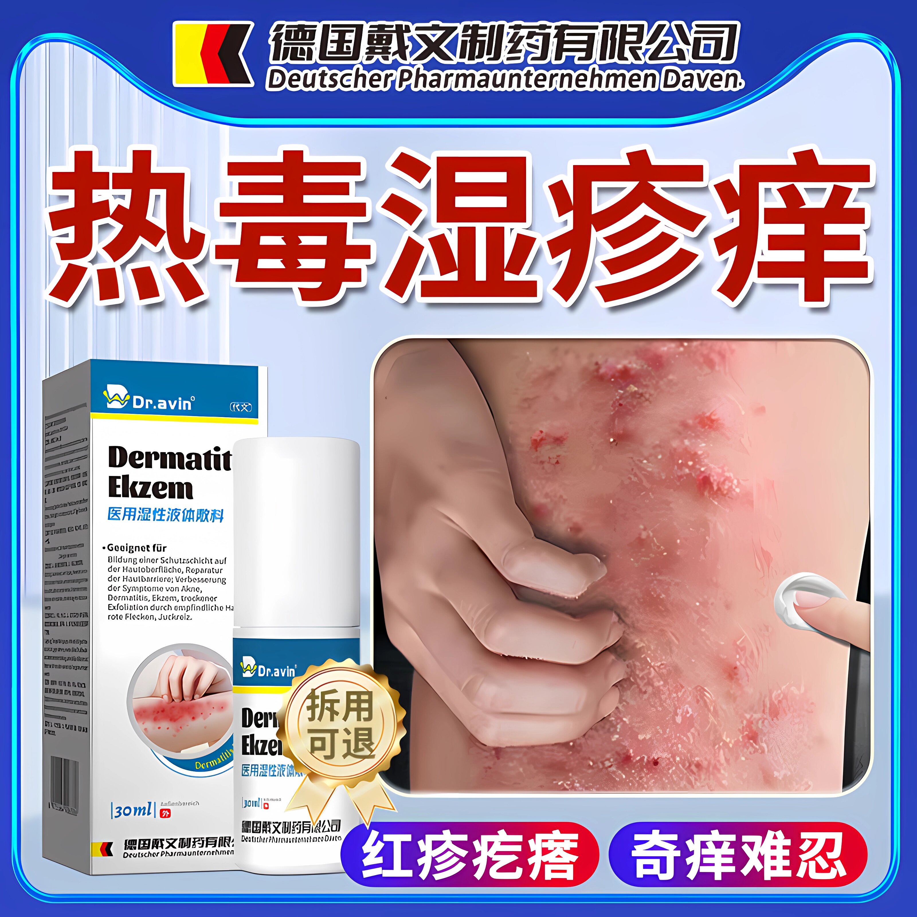 热毒湿疹专用除湿止痒膏治皮肤湿疹皮炎红斑瘙痒去水泡根喷雾ZR