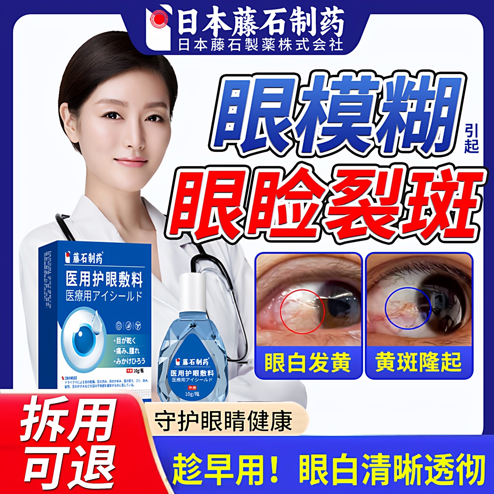 眼睑裂斑眼底黄斑病变可搭眼药水滴眼液眼白发黄眼睛清澈去黄ZR